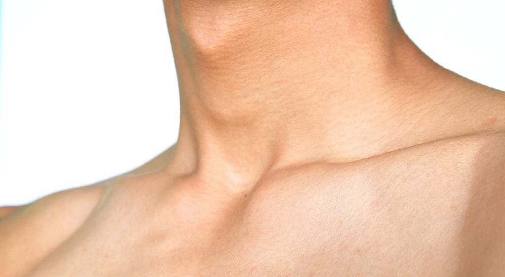 경추척수증-운동