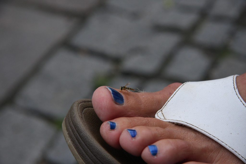 모공각화증-색소침착