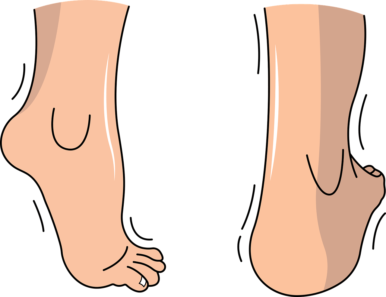발목인대 끊어지면 나타나는 증상