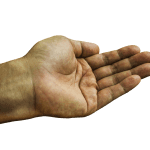 왼손-손바닥-통증