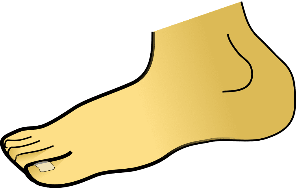 평발 군대 면제