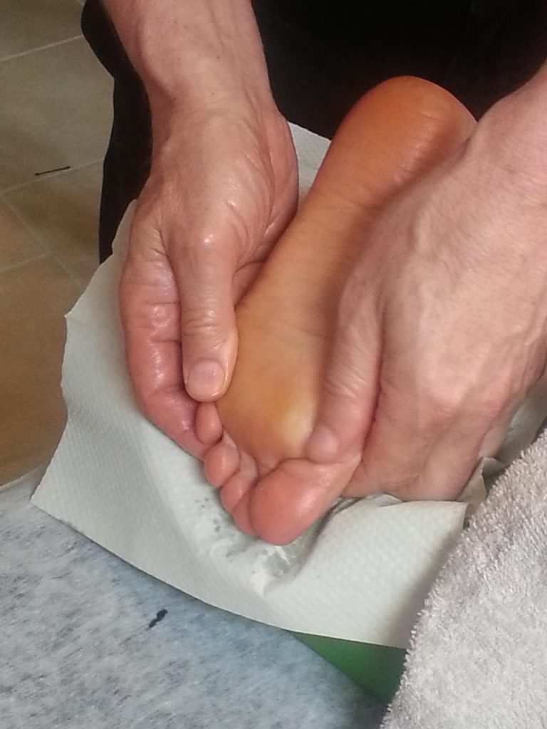 하지정맥류 자연치유